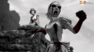 Hysteria